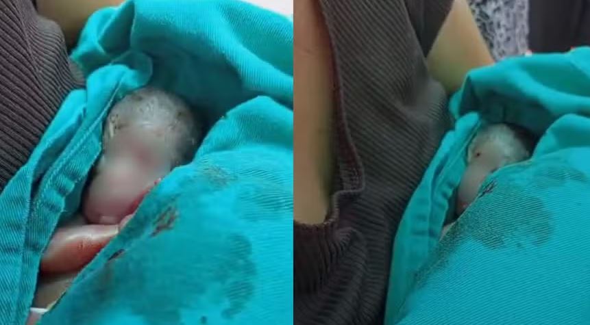 Morre recém-nascido que chorou dentro de caixão durante velório no Acre Equipe médica na Maternidade Bárbara Heliodora, em Rio Branco, onde bebê foi declarado natimorto e faleceu